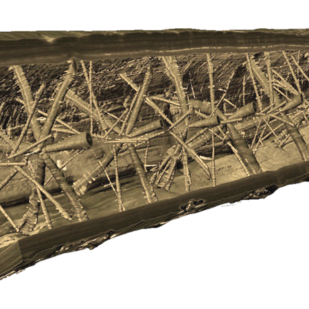 Computed Tomography (CT)